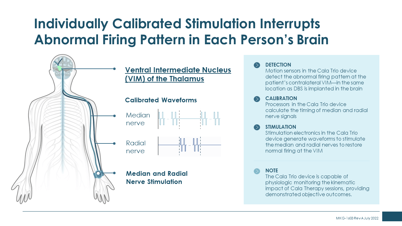 slide-of-individually-calibrated-stimulation-interrupts-abnormal-firing-pattern-in-each-persons-brain.png