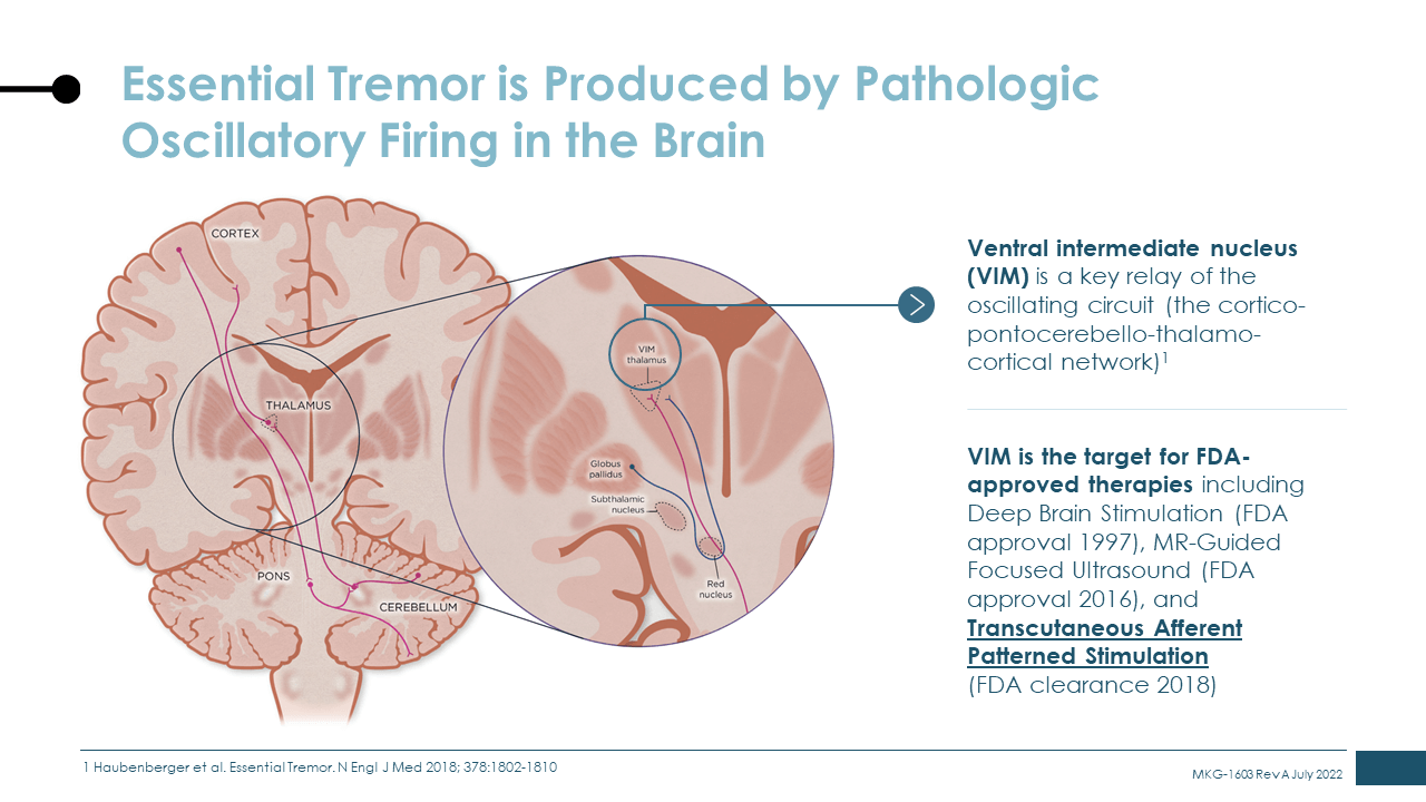 slide-of-essential-tremor-is-produced-by-pathologic-oscillatory-firing-in-the-brain.png